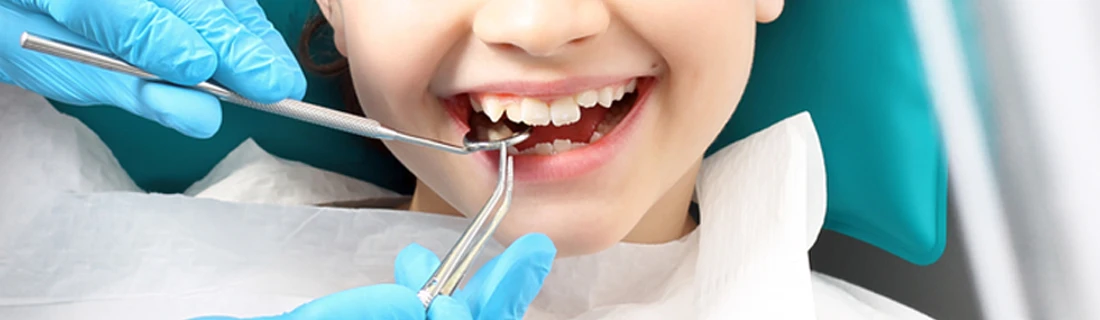 Tooth Extractions in Phoenix AZ